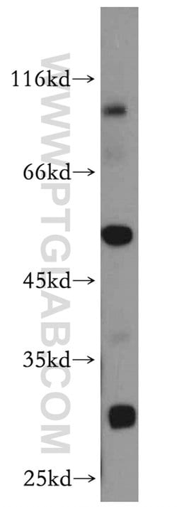 DPP7 Rabbit anti-Human, Mouse, Rat, Polyclonal, Proteintech 150 &mu;L | Buy Online | Proteintech Group Inc | Fisher Scientific