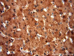 SGMS1 Rabbit anti-Human, Mouse, Rat, Polyclonal, Proteintech:Anticorps:Anticorps
