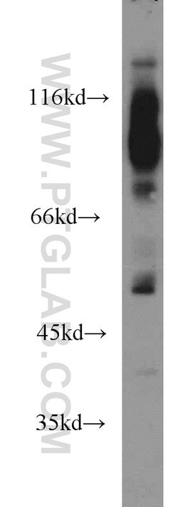 Proteintech SGMS1 Rabbit anti-Human, Mouse, Rat, Polyclonal, Proteintech
