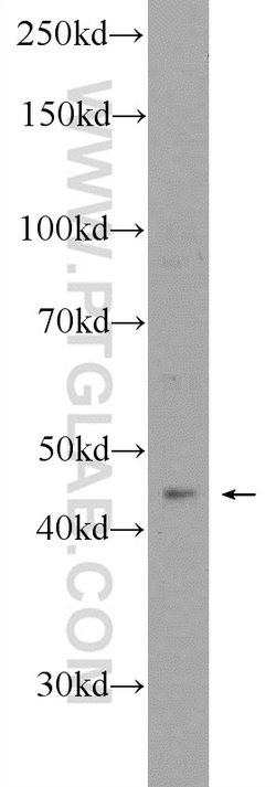 MDM2 Rabbit anti-Human, Mouse, Rat, Polyclonal, Proteintech 20 &mu;L; Unconjugated:Antibodies,