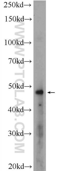 MDM2 Rabbit anti-Human, Mouse, Rat, Polyclonal, Proteintech 20 &mu;L; Unconjugated:Antibodies,