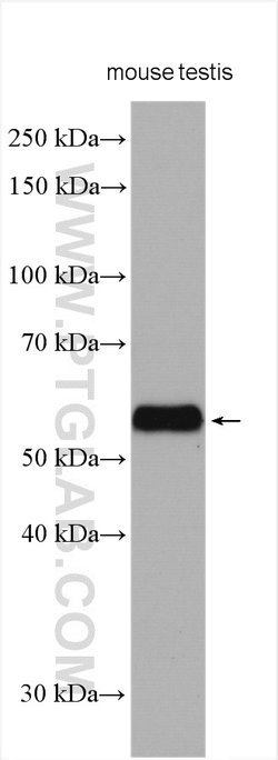 ARSA Rabbit anti-Human, Mouse, Rat, Polyclonal, Proteintech:Antibodies:Primary