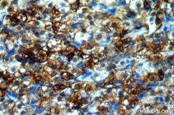 BAG1 Rabbit anti-Human, Mouse, Rat, Polyclonal, Proteintech:Antibodies:Primary