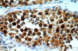 BAG1 Rabbit anti-Human, Mouse, Rat, Polyclonal, Proteintech:Antibodies:Primary