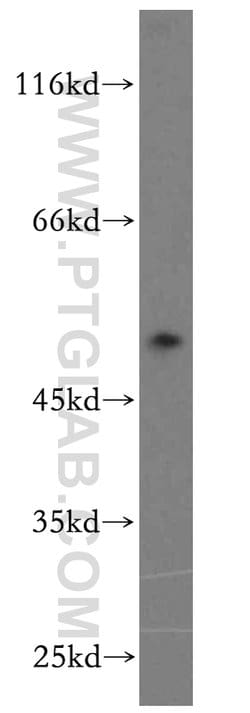 BAG1 Rabbit anti-Human, Mouse, Rat, Polyclonal, Proteintech:Antibodies:Primary