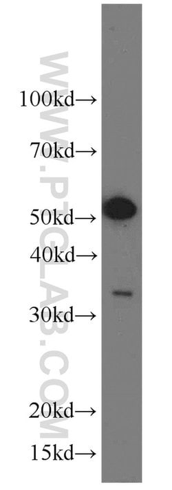 BAG1 Rabbit anti-Human, Mouse, Rat, Polyclonal, Proteintech:Antibodies:Primary
