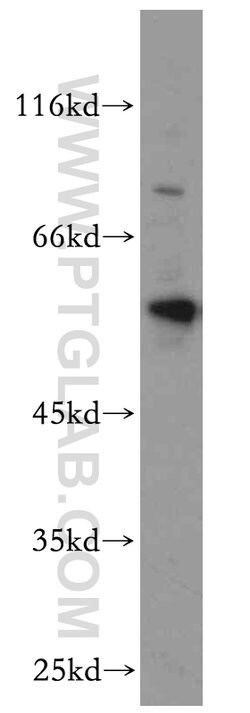 BAG1 Rabbit anti-Human, Mouse, Rat, Polyclonal, Proteintech:Antibodies:Primary