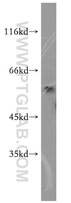 BAG1 Rabbit anti-Human, Mouse, Rat, Polyclonal, Proteintech:Antibodies:Primary