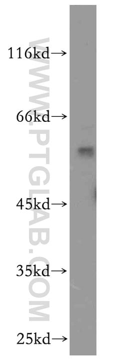 BAG1 Rabbit anti-Human, Mouse, Rat, Polyclonal, Proteintech:Antibodies:Primary