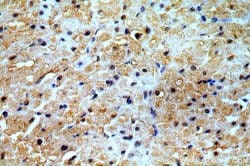 PRICKLE3 Rabbit anti-Human, Mouse, Rat, Polyclonal, Proteintech:Antibodies:Primary