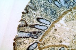 PRICKLE3 Rabbit anti-Human, Mouse, Rat, Polyclonal, Proteintech:Antibodies:Primary