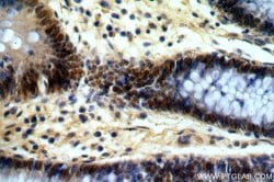 PRICKLE3 Rabbit anti-Human, Mouse, Rat, Polyclonal, Proteintech:Antibodies:Primary