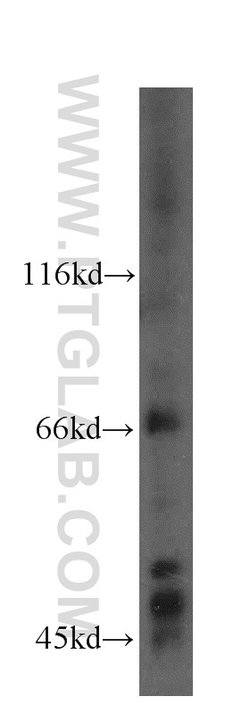 PRICKLE3 Rabbit anti-Human, Mouse, Rat, Polyclonal, Proteintech:Antibodies:Primary