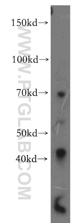 PRICKLE3 Rabbit anti-Human, Mouse, Rat, Polyclonal, Proteintech:Antibodies:Primary