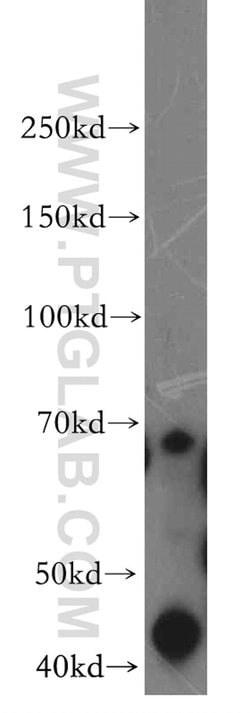 PRICKLE3 Rabbit anti-Human, Mouse, Rat, Polyclonal, Proteintech:Antibodies:Primary