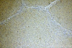 EPAC2 Rabbit anti-Human, Mouse, Rat, Polyclonal, Proteintech:Antibodies:Primary