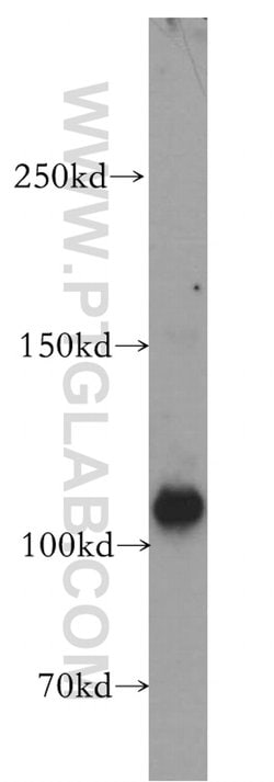 EPAC2 Rabbit anti-Human, Mouse, Rat, Polyclonal, Proteintech:Antibodies:Primary
