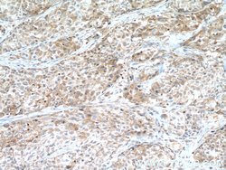 CDK6 Rabbit anti-Human, Mouse, Rat, Polyclonal, Proteintech:Antibodies:Primary