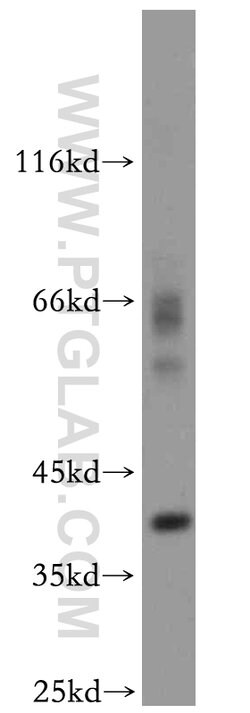 CDK6 Rabbit anti-Human, Mouse, Rat, Polyclonal, Proteintech:Antibodies:Primary