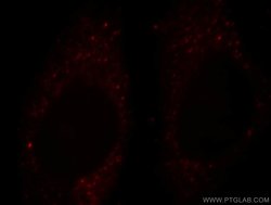 FOXO4 Rabbit anti-Human, Mouse, Polyclonal, Proteintech 20 &mu;L; Unconjugated:Antibodies