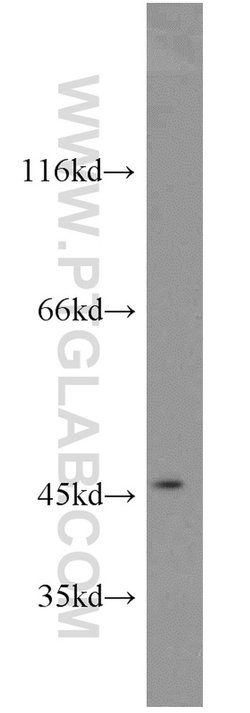 FOXO4 Rabbit anti-Human, Mouse, Polyclonal, Proteintech 20 &mu;L; Unconjugated:Antibodies