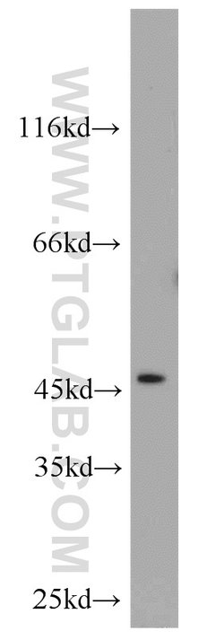 FOXO4 Rabbit anti-Human, Mouse, Polyclonal, Proteintech 20 &mu;L; Unconjugated:Antibodies