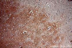 PLCH1 Rabbit anti-Human, Mouse, Rat, Polyclonal, Proteintech 20 &mu;L;