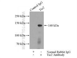 Tie2 Rabbit anti-Human, Mouse, Rat, Polyclonal, Proteintech 150 &mu;L;