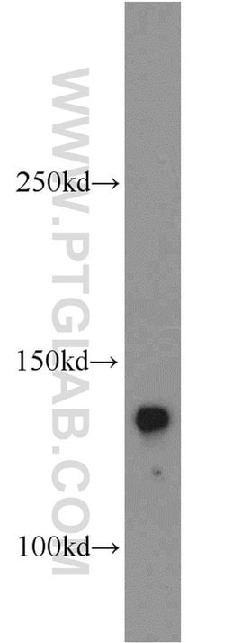 Tie2 Rabbit anti-Human, Mouse, Rat, Polyclonal, Proteintech 150 &mu;L;