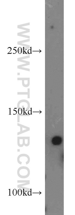 Tie2 Rabbit anti-Human, Mouse, Rat, Polyclonal, Proteintech 150 &mu;L;