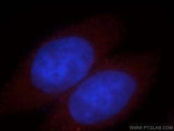 FKBP6 Rabbit anti-Human, Polyclonal, Proteintech 150 &mu;L; Unconjugated:Antibodies,