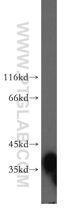 FKBP6 Rabbit anti-Human, Polyclonal, Proteintech 150 &mu;L; Unconjugated:Antibodies,