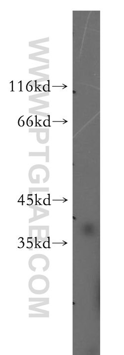 FKBP6 Rabbit anti-Human, Polyclonal, Proteintech 150 &mu;L; Unconjugated:Antibodies,