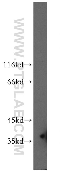 FKBP6 Rabbit anti-Human, Polyclonal, Proteintech 150 &mu;L; Unconjugated:Antibodies,