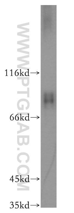 Proteintech RAP1GAP Rabbit anti-Human, Mouse, Rat, Polyclonal, Proteintech