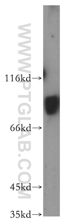 RAP1GAP Rabbit anti-Human, Mouse, Rat, Polyclonal, Proteintech:Antibodies:Primary