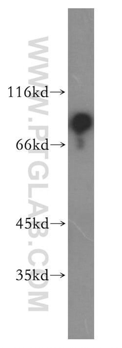 RAP1GAP Rabbit anti-Human, Mouse, Rat, Polyclonal, Proteintech:Antibodies:Primary