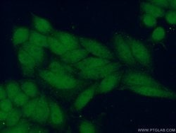 FANCL Rabbit anti-Human, Mouse, Rat, Polyclonal, Proteintech 150 &mu;L;