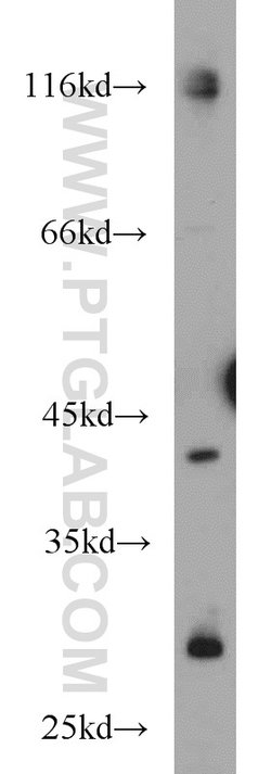 FANCL Rabbit anti-Human, Mouse, Rat, Polyclonal, Proteintech 150 &mu;L;