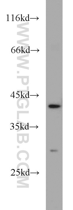 FANCL Rabbit anti-Human, Mouse, Rat, Polyclonal, Proteintech 150 &mu;L;