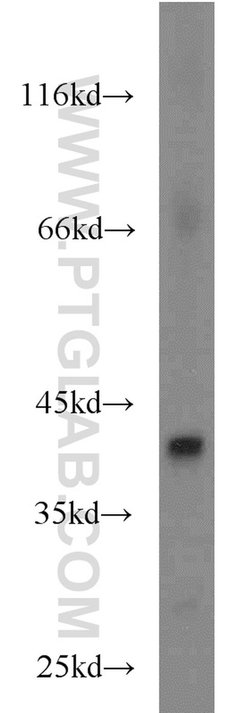 FANCL Rabbit anti-Human, Mouse, Rat, Polyclonal, Proteintech 150 &mu;L;
