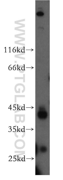 FANCL Rabbit anti-Human, Mouse, Rat, Polyclonal, Proteintech 150 &mu;L;