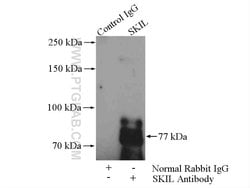SKIL Rabbit anti-Human, Mouse, Rat, Polyclonal, Proteintech:Antibodies:Primary