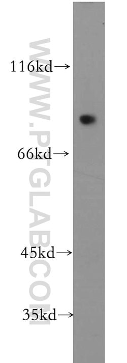 SKIL Rabbit anti-Human, Mouse, Rat, Polyclonal, Proteintech:Antibodies:Primary