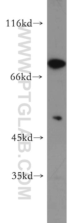 SKIL Rabbit anti-Human, Mouse, Rat, Polyclonal, Proteintech:Antibodies:Primary