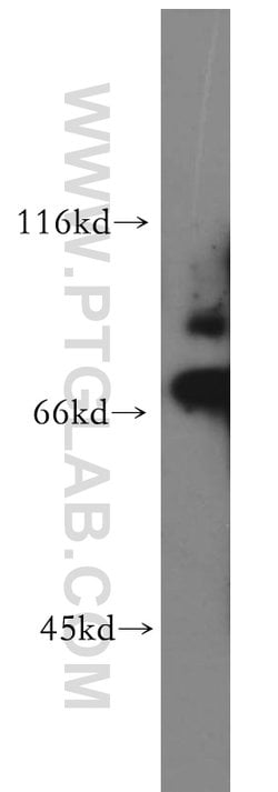SKIL Rabbit anti-Human, Mouse, Rat, Polyclonal, Proteintech:Antibodies:Primary