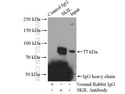 SKIL Rabbit anti-Human, Mouse, Rat, Polyclonal, Proteintech:Antibodies:Primary