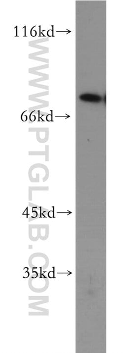 SKIL Rabbit anti-Human, Mouse, Rat, Polyclonal, Proteintech:Antibodies:Primary