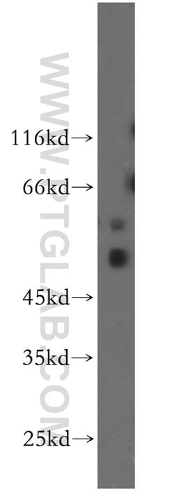 CDC42EP4 Rabbit anti-Human, Mouse, Rat, Polyclonal, Proteintech:Antibodies:Primary