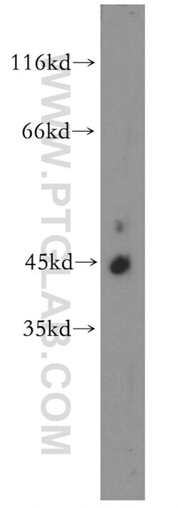 CDC42EP4 Rabbit anti-Human, Mouse, Rat, Polyclonal, Proteintech:Antibodies:Primary